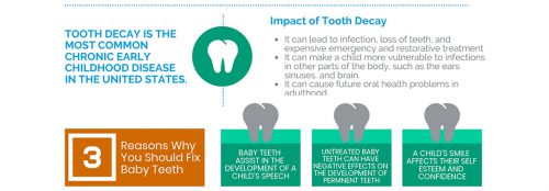 Impact of Tooth Decay